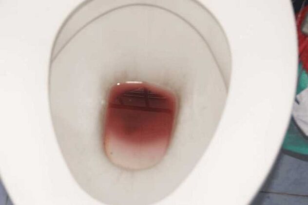 Repères chez les hommes lorsqu'ils sont excités